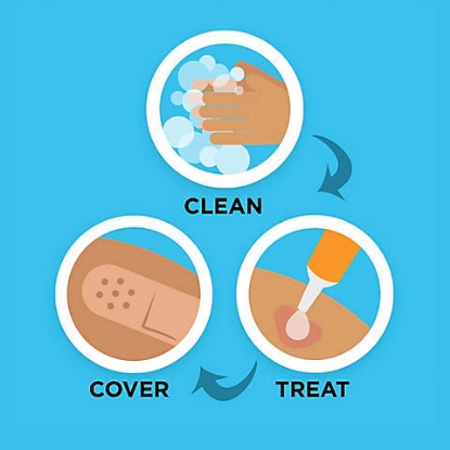 Band-Aid Brand Flexible Fabric Adhesive Bandages for Minor Wound Care 100 ct